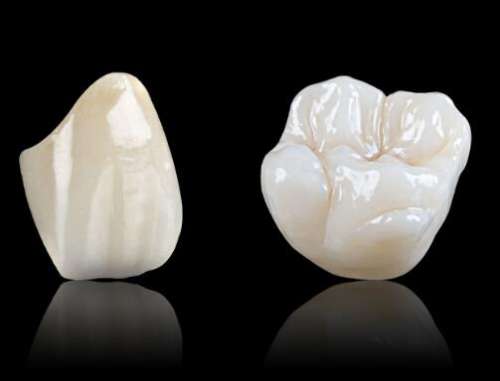 牙齿修复技术大比拼：全瓷牙与烤瓷牙谁更胜一筹？